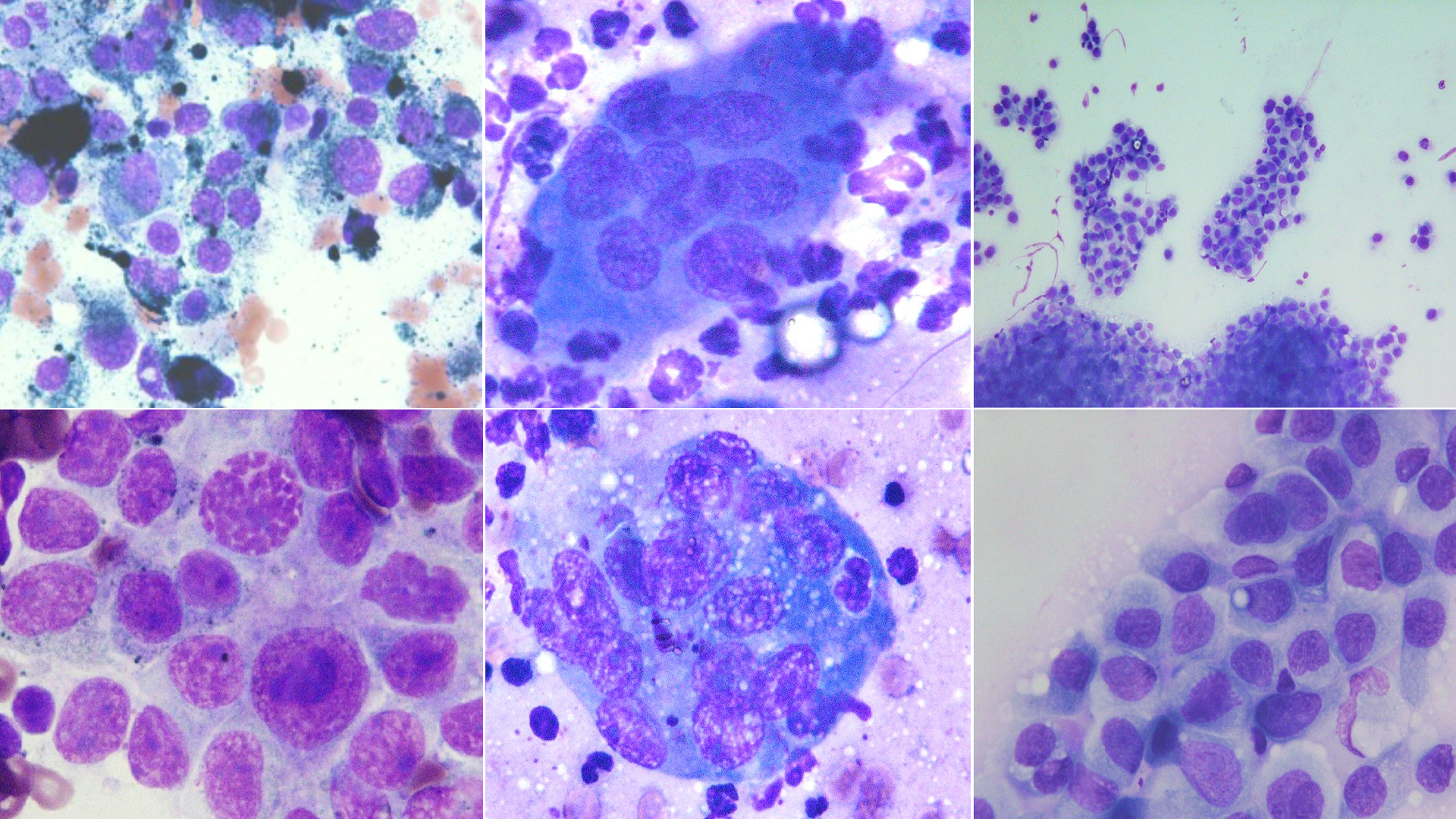 コロイド銀とガン